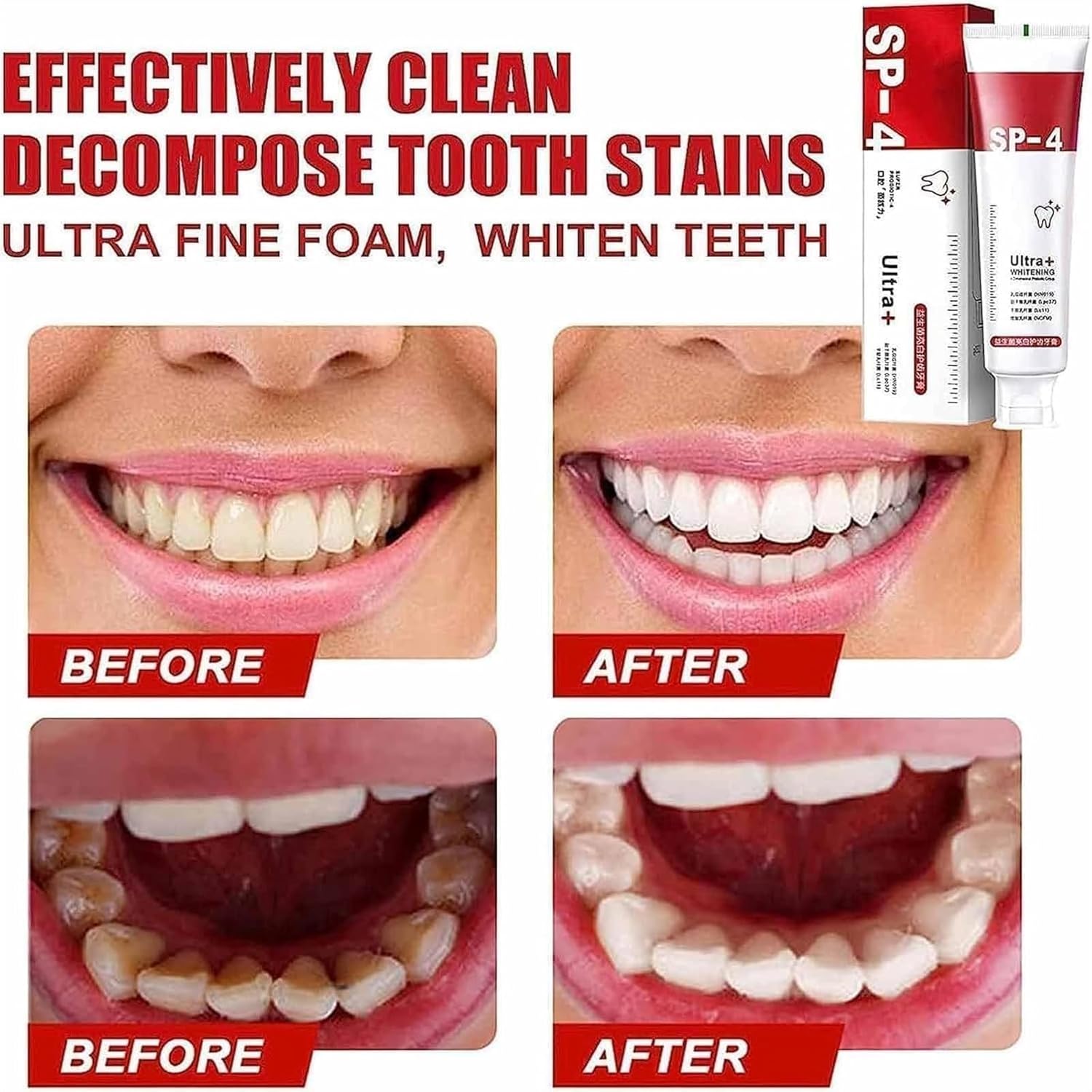 Yayashi Sp-4 Ultra Whitening Toothpaste
